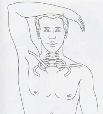 <p>Shoulder Abduction/ Brakody’s</p>