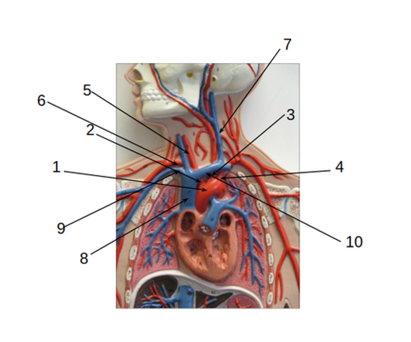<p>What structure is #3?</p>
