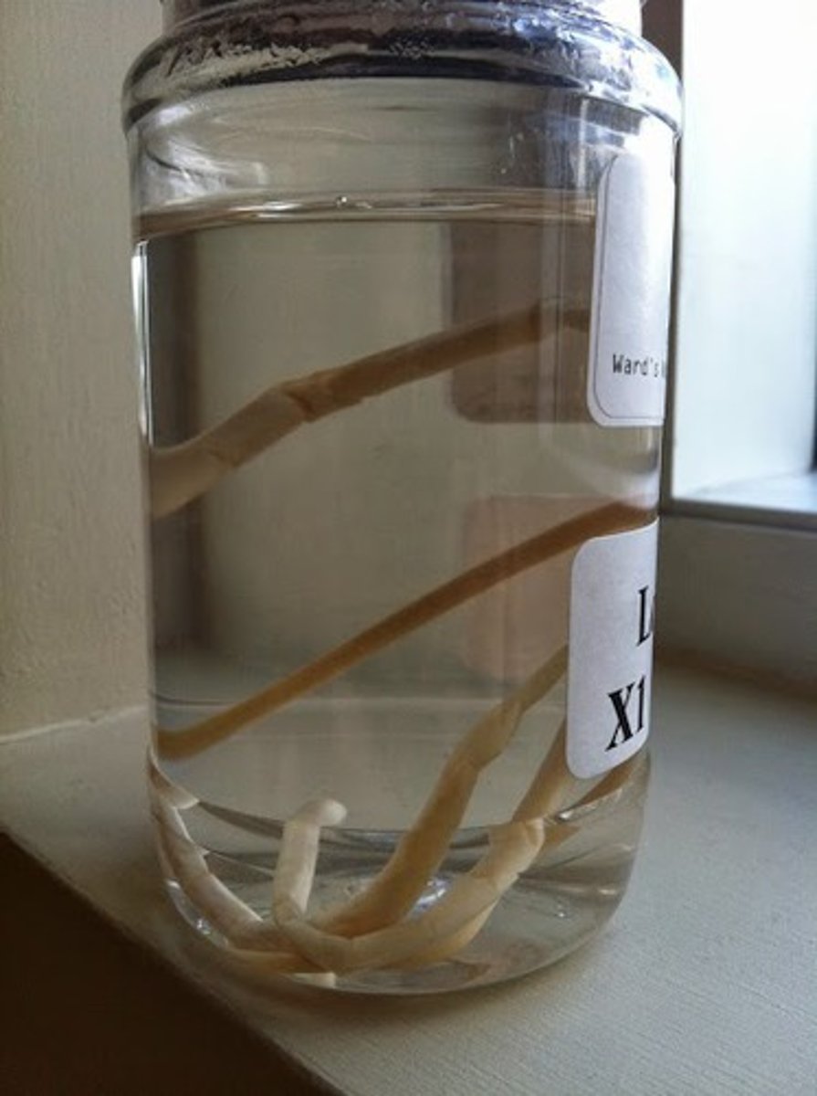 <p>Phylum of nematodes</p><p>- ex. Ascaris</p><p>- pseudocoelomate</p><p>- hooked and smaller = male</p><p>- a pale brown and kind of wrinkly looking</p>