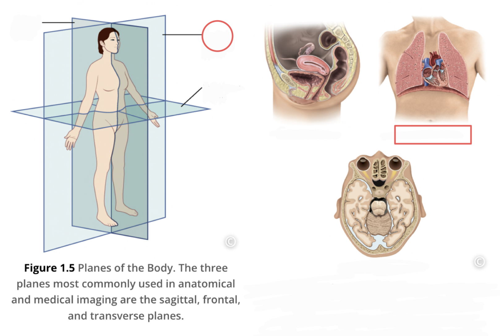 <p>divides the body or organ into anterior and posterior portions</p>