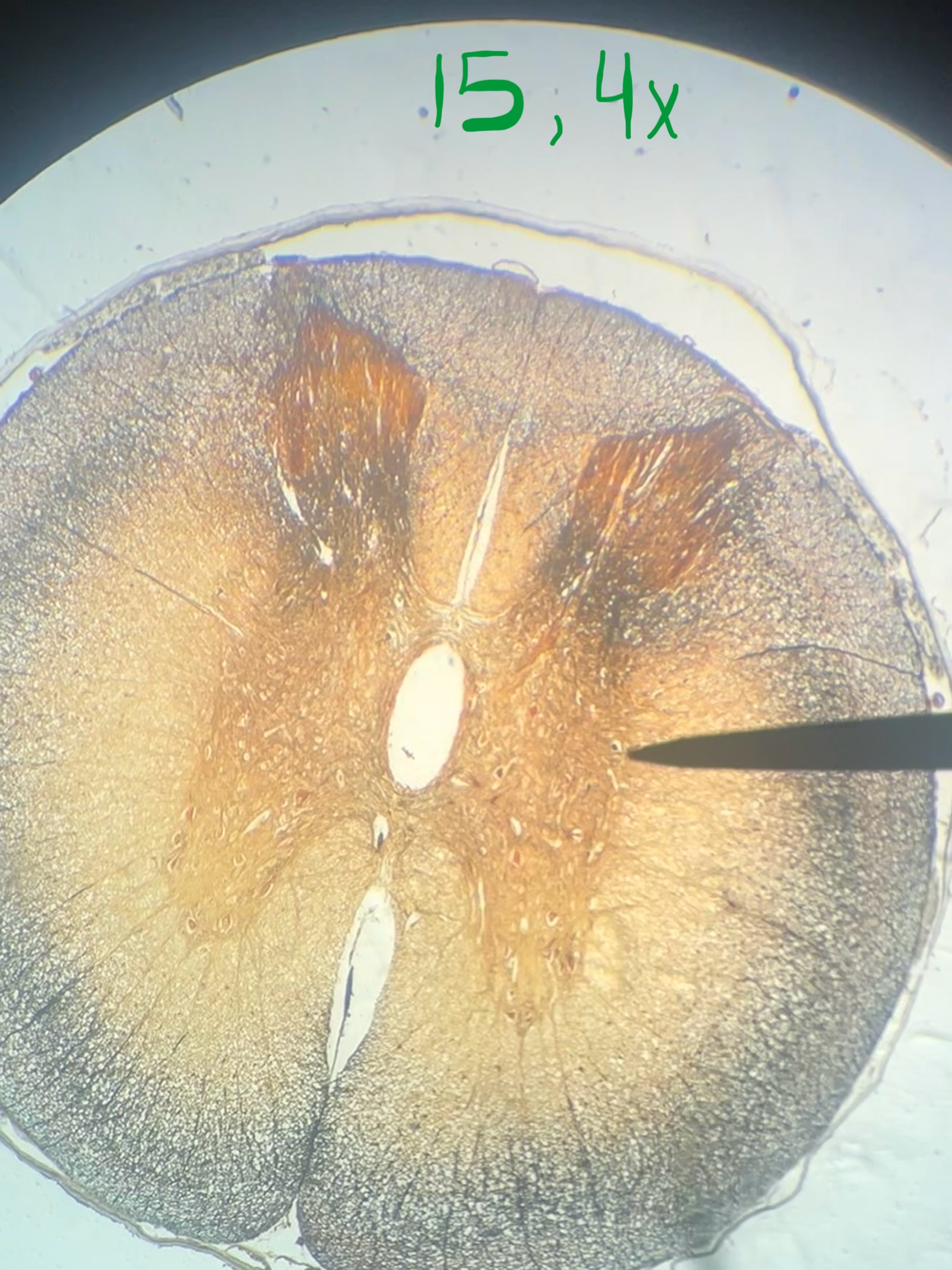 <p>Spinal cord</p>