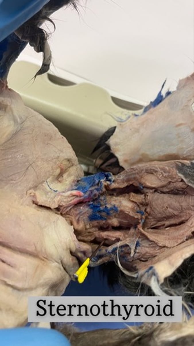 <p>origin: manubrium and first or second costal cartilage</p><p>insertion: thyroid cartilage</p><p>action: depresses larynx, fixes hyoid when opening mouth</p>