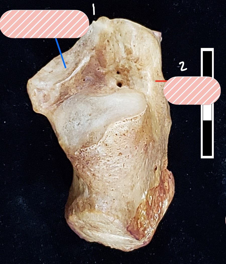 <p>Label 1</p>