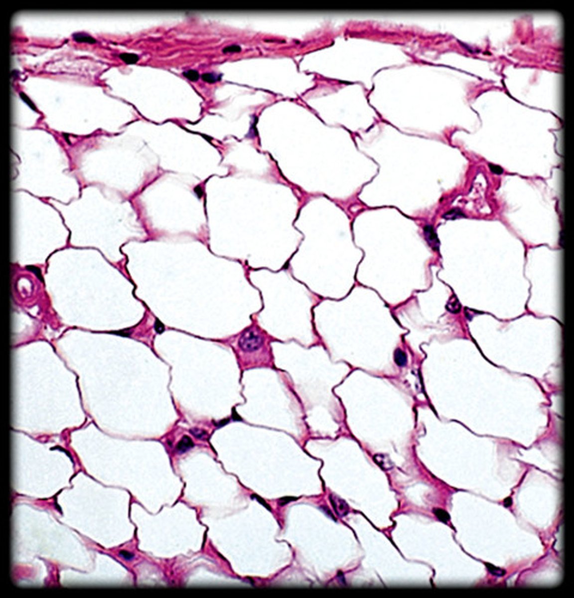 <p>- Fat-storing tissue.</p><p>- Large, empty-looking cells with nuclei pushed to the edge. - - Large, circular cells with clear centers.</p><p>- Found under the skin, around organs, and in bone marrow.</p>