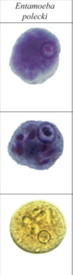 <p>Entamoeba polecki </p>