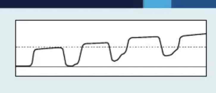 <p>which Capnography waveform is this</p>