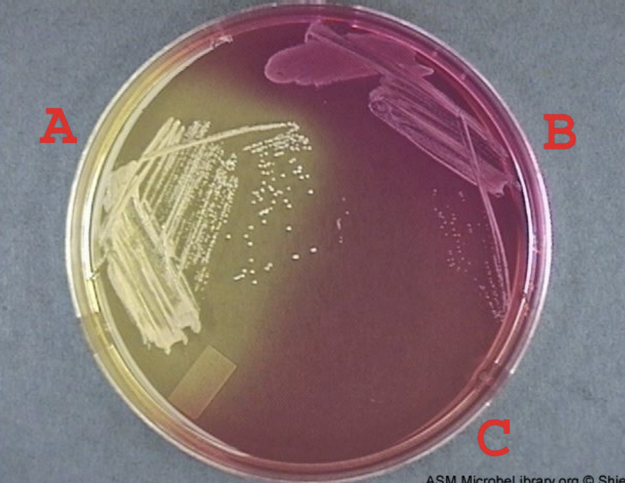 <p>Classification: Differential and Selective</p><p>Ingredients: Beef extract, Peptone</p><p>Lab Usage: Isolates staphylococci aureus</p><p>Results: Yellow - mannitol fermenting, pink - nonfermenting colony</p>