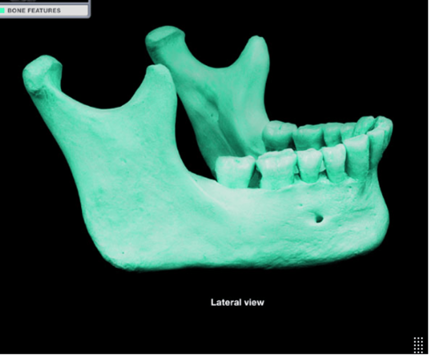 <p>Lower jawbone, the only movable skull bone.</p>