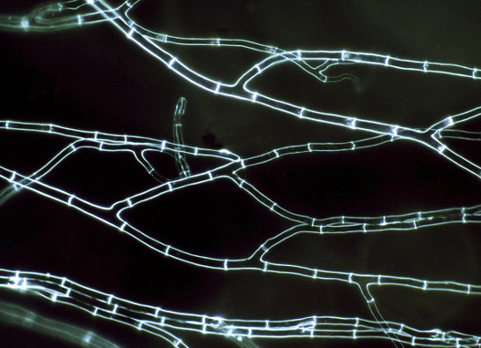 <p>is this hyphae septate or coenocytic</p>