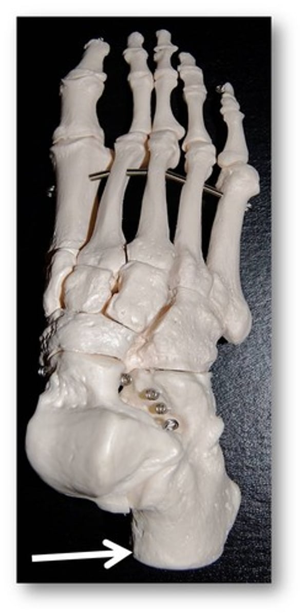 <p>Name this specific bone of the foot.</p>