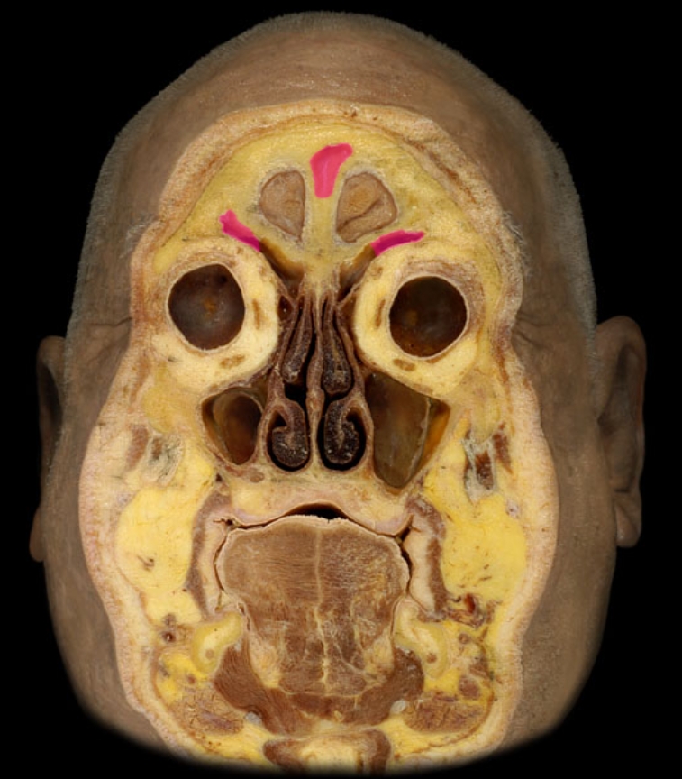 term image