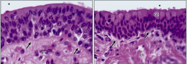 <ul><li><p><strong>Not common</strong></p></li><li><p>Found in the <strong>male urethra</strong> and <strong>palpebral conjunctiva</strong> (inner eyelid)</p></li></ul><p></p>