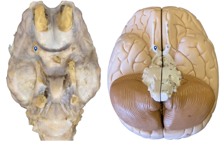 <p>What cranial nerve is the arrow pointing to?</p>