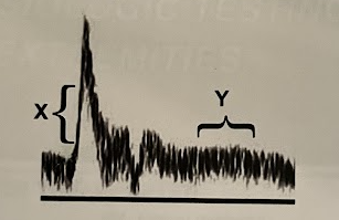 <p>Which of the following statements best describes the flow profiles at “X” and “Y” in this spectral Doppler waveform</p>