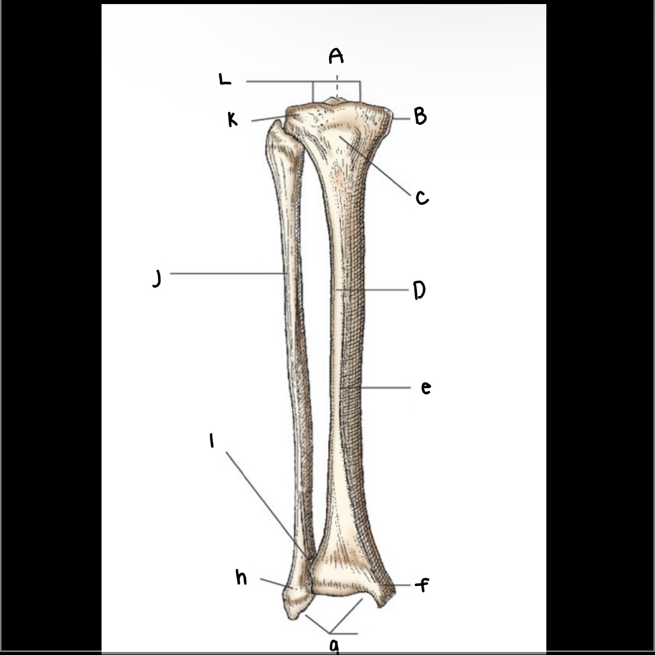 <p>What is letter H pointing to?</p>
