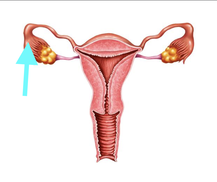 <p>What structure is shown?</p>