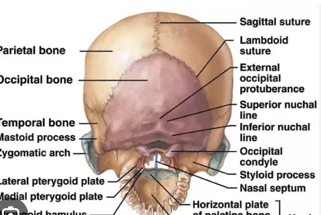 <p>External occipital perturbance</p>