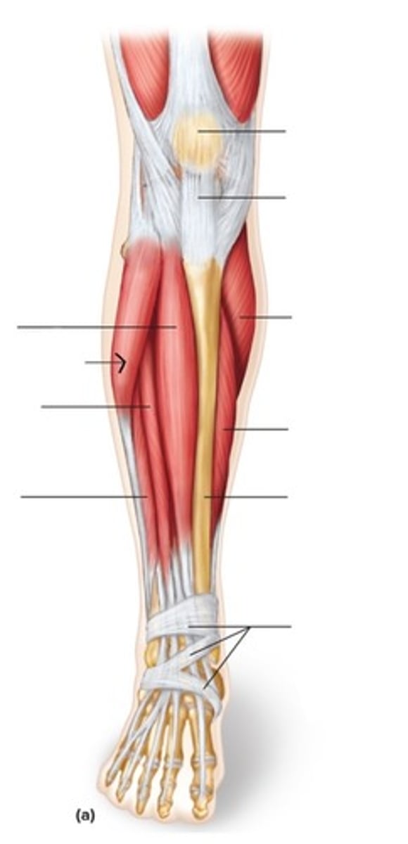<p>What muscle is this?</p>