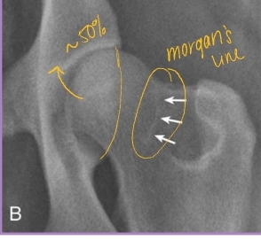 <p><span style="background-color: transparent;"><strong><span>Diagnostic Imaging for Hip Dysplasia</span></strong></span></p>