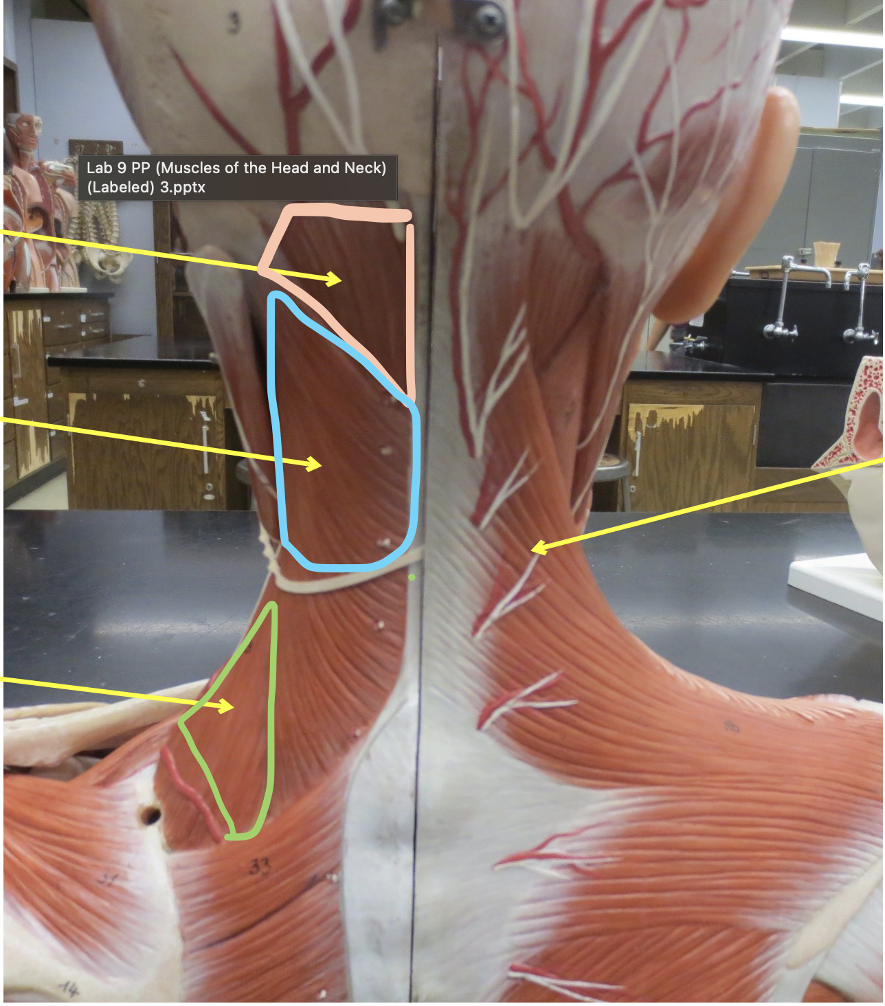 <p>Which muscle in green</p>