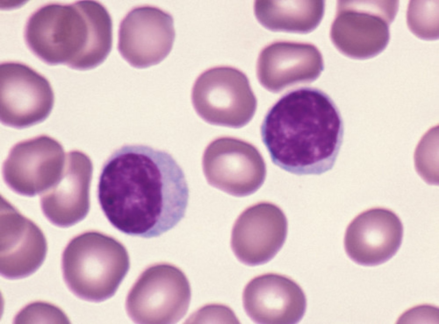 <p>- round nucleases; responsible for specific immunity<br>- primary cells of lymphatic system<br>- differentiates into T cells, B cells, and NK cells</p>