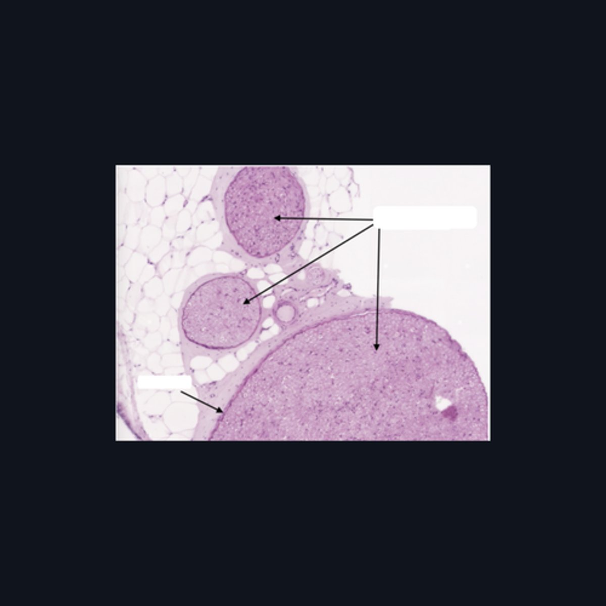 <p>Identify where this structure is found</p>