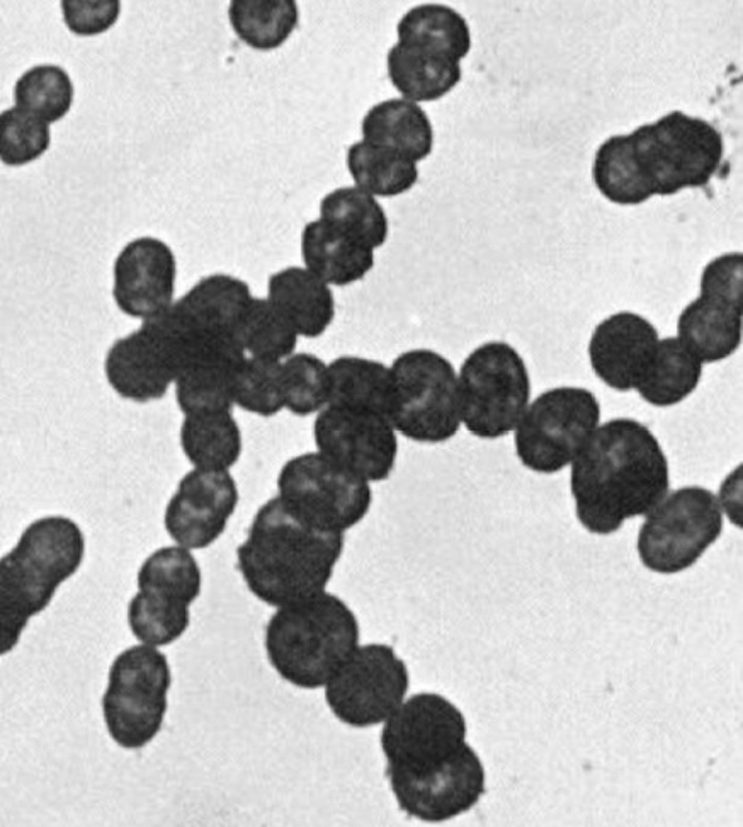 <p>Streptococci</p>
