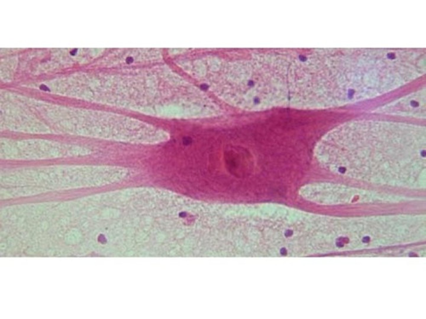<p>most common, carries signal away from CNS to effector like muscle/glands</p>