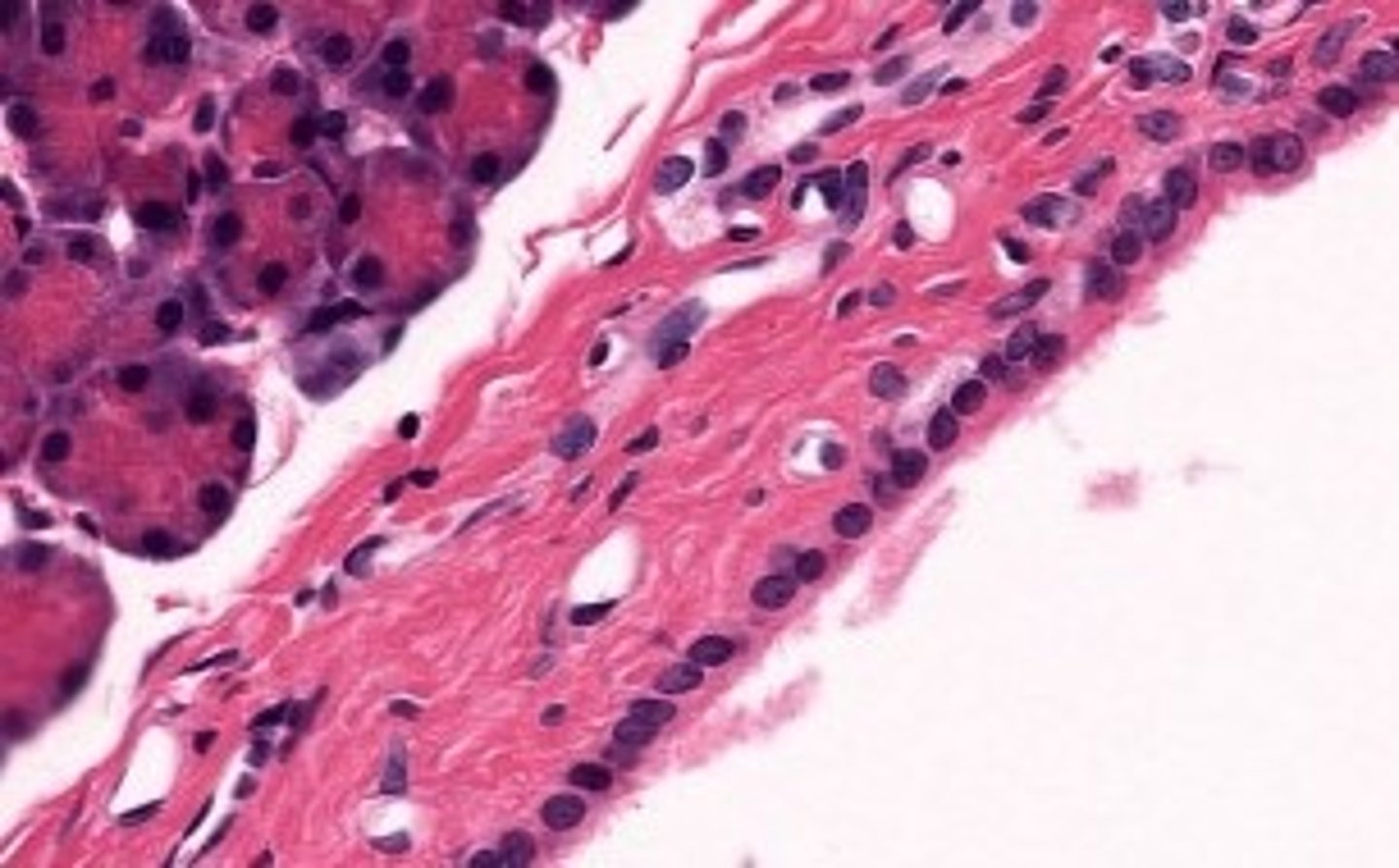 <p>larger ducts of pancreas</p>