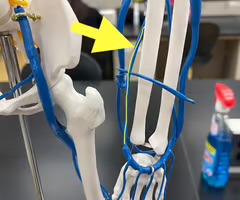 <p>Name the blood vessel.</p>