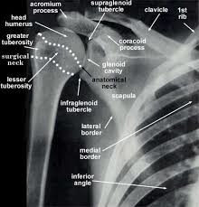 Infraglenoid Tubercle