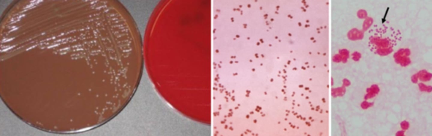 <p>-Grows on chocolate</p><p>-Grows on Thayer Martin</p><p>-Does NOT grow on blood</p><p>-Intracellular (neutrophil) -gram negative diplococci (GNDC), male swab in urethra and identify right away</p>