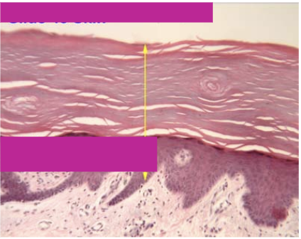 <p>Top layer of cells- dead, lower layers are living. Their function is protection against abrasion. These are found in on the skin</p>