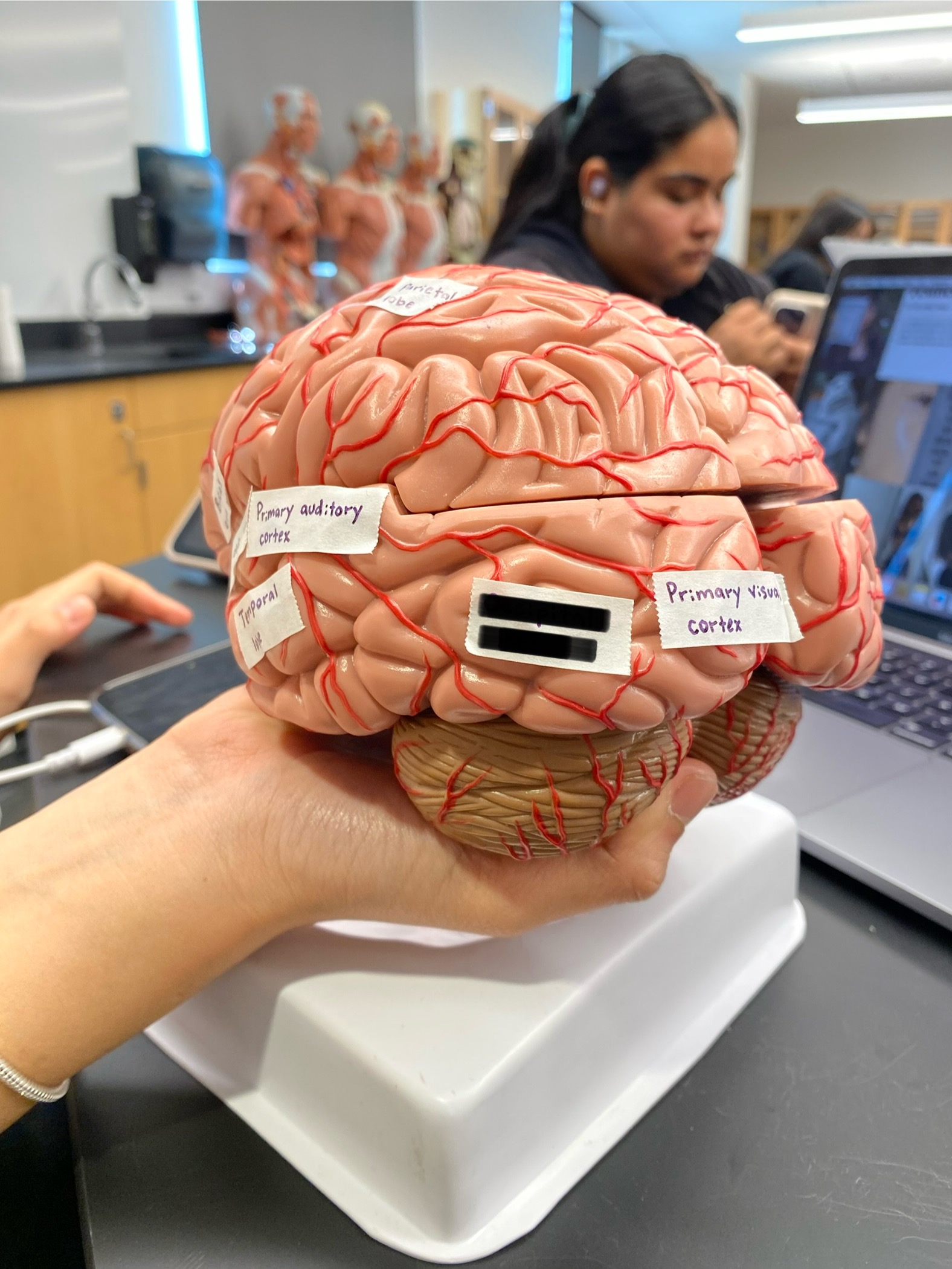 <p>ID lobe</p>