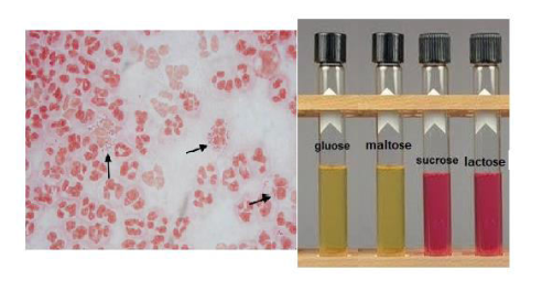<p>What is the specimen used in the diagnosis of this organism</p>