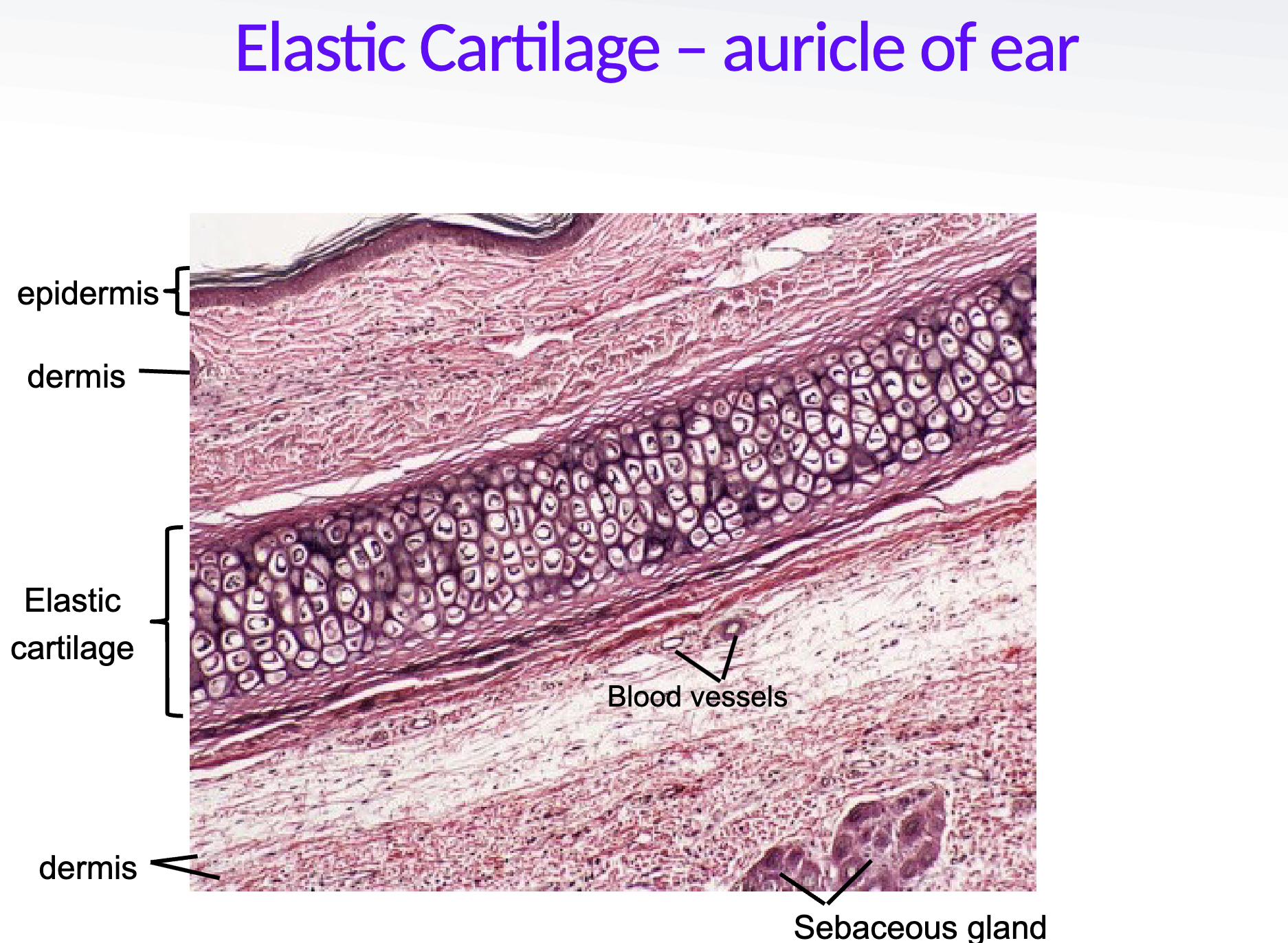 <ul><li><p>external ear, epiglottis, external auditory meatus</p></li><li><p>flexible support</p></li></ul><p></p>