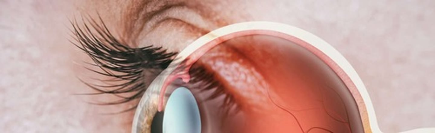 <p>Transparent part of the eye that helps to focus light on the retina.</p>