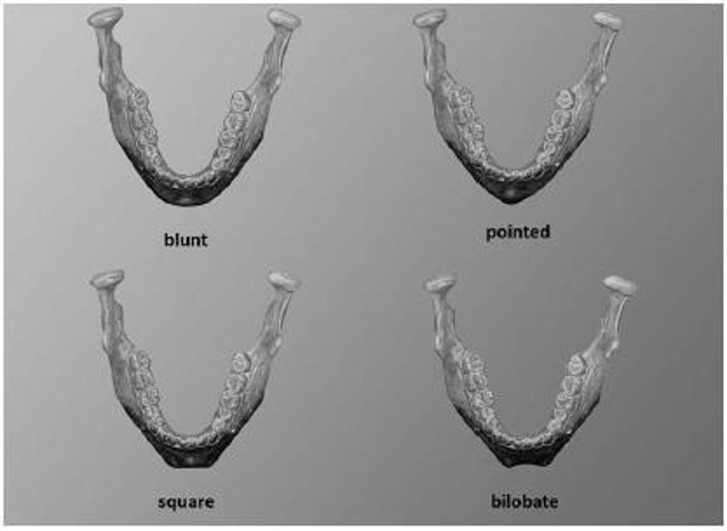 <p>Ramus inversion, gonial flare, chin shape, and mandibular tori.</p>
