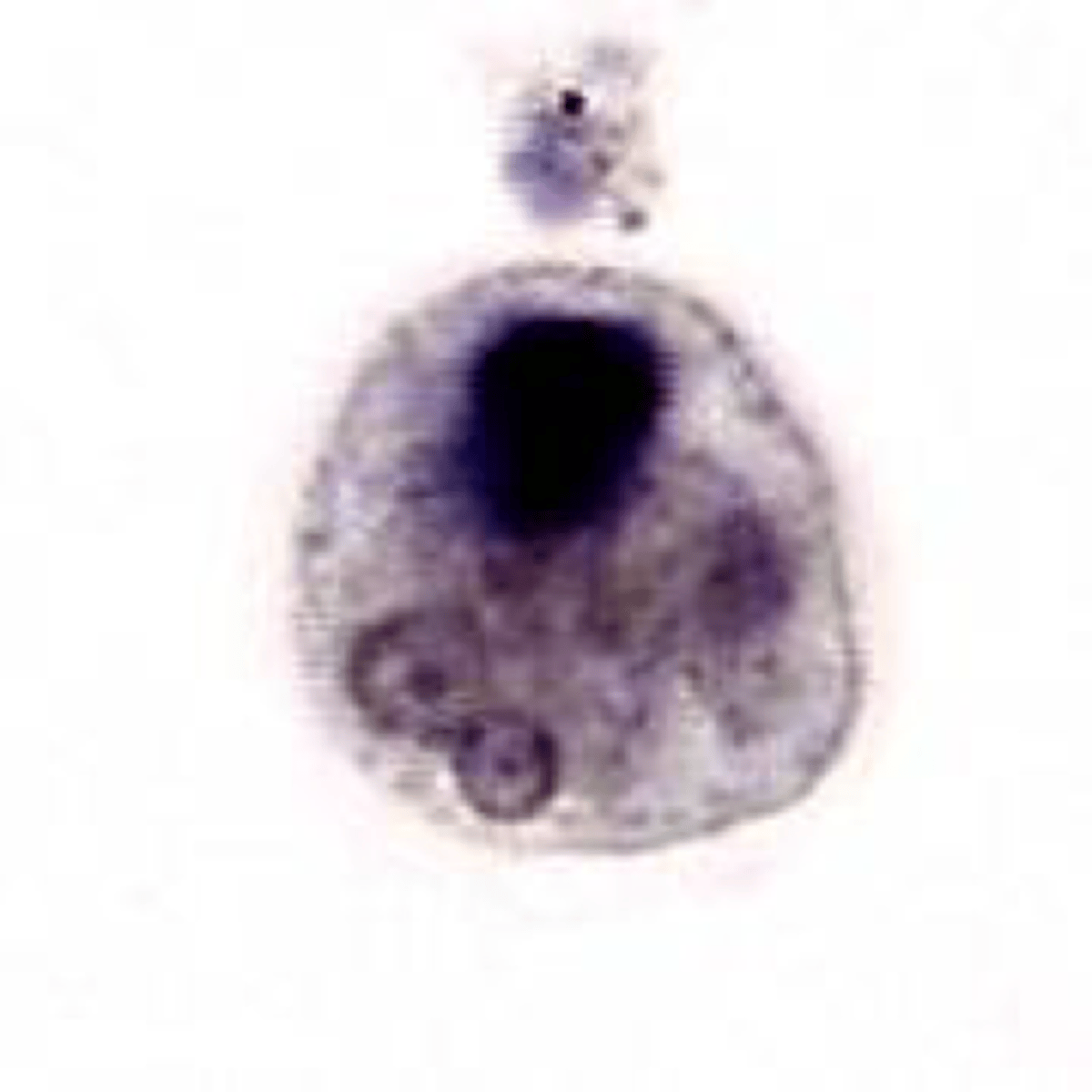 <p>Name the stage and species. NOTE: There are FOUR nuclei (not all are shown here) and the dark spot is chormatoidal bars with rounded ends.</p>