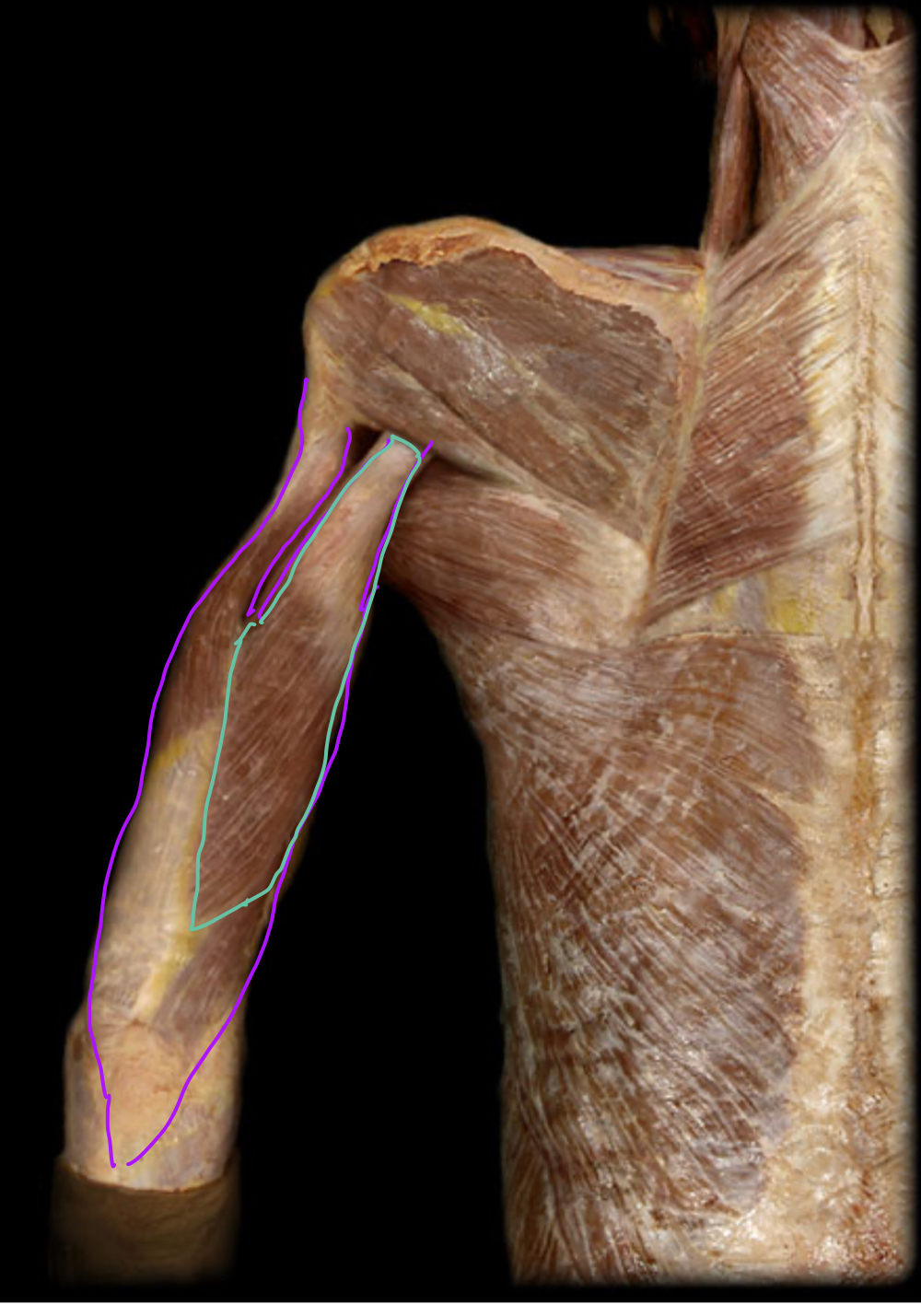 <p>Innervation</p>