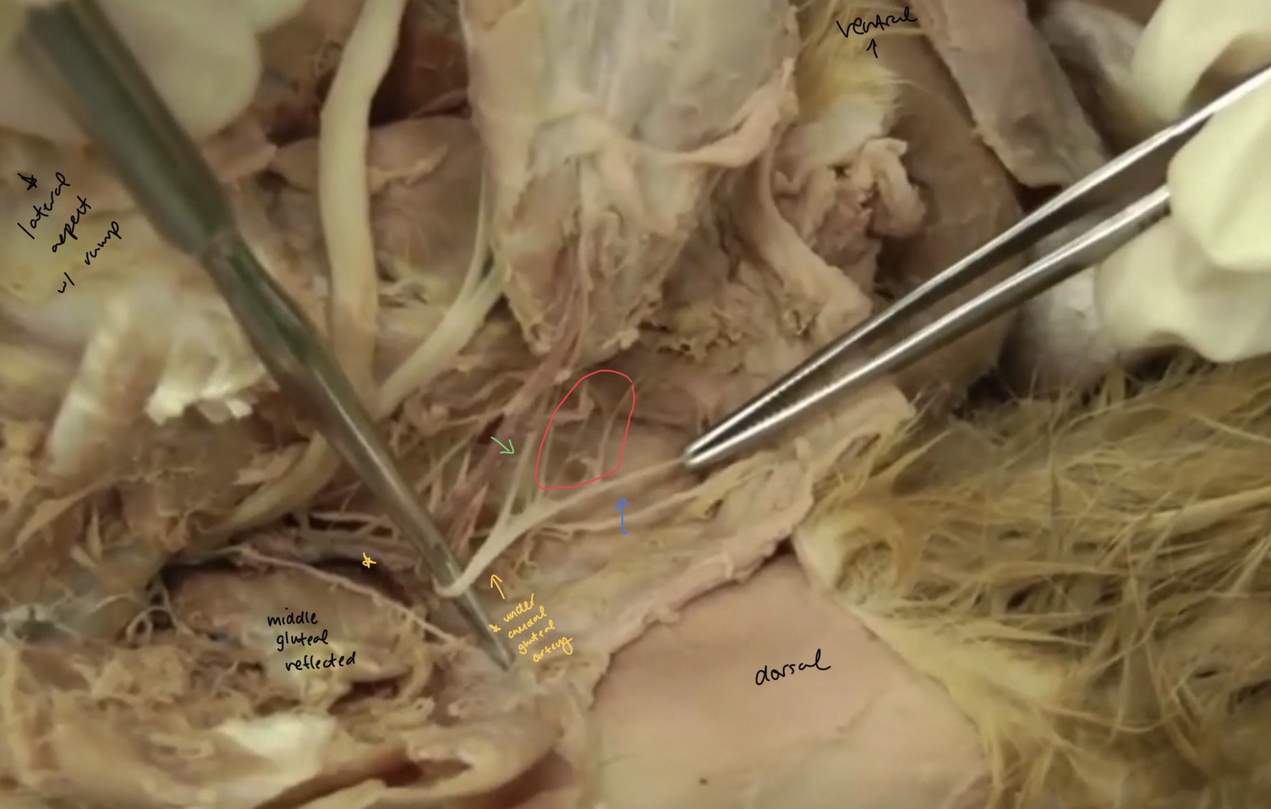 <p>what is the green nerve?&nbsp;(I don’t think we need to know this, but connects to penis)</p>