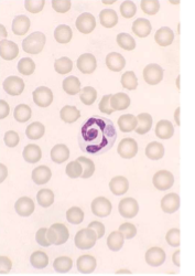 <p>what species does <span style="color: rgb(255, 255, 255);"><span>Ehrlichia spp.; E. canis/E. ewingii infect </span></span></p>