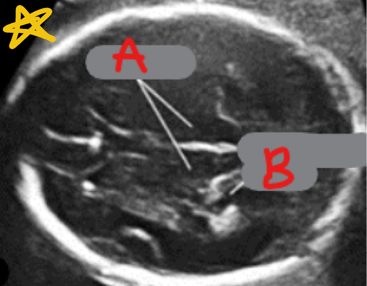 <p>What is labeled as A?</p>