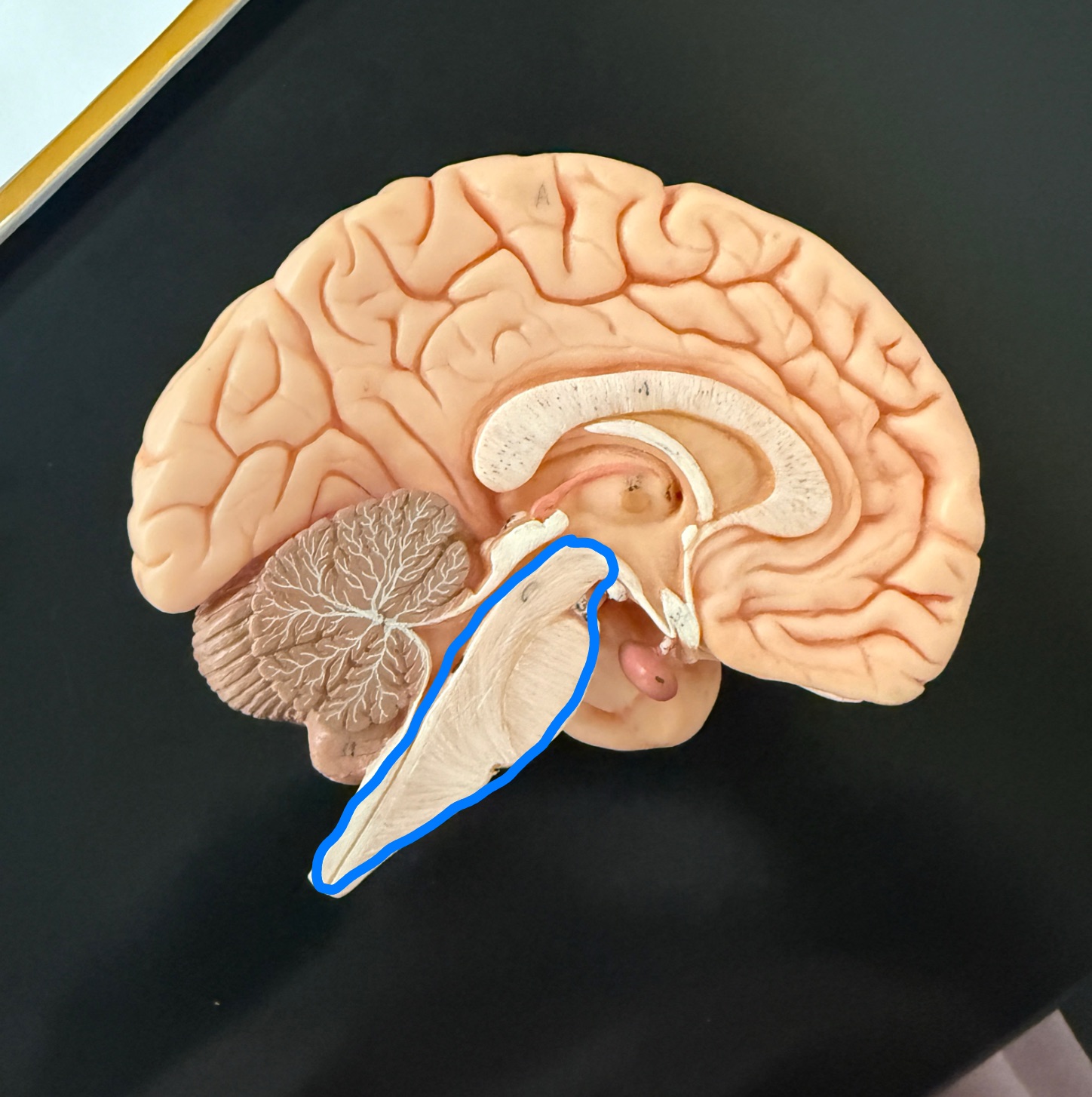 <p>What is outlined in blue on the brain model?</p>