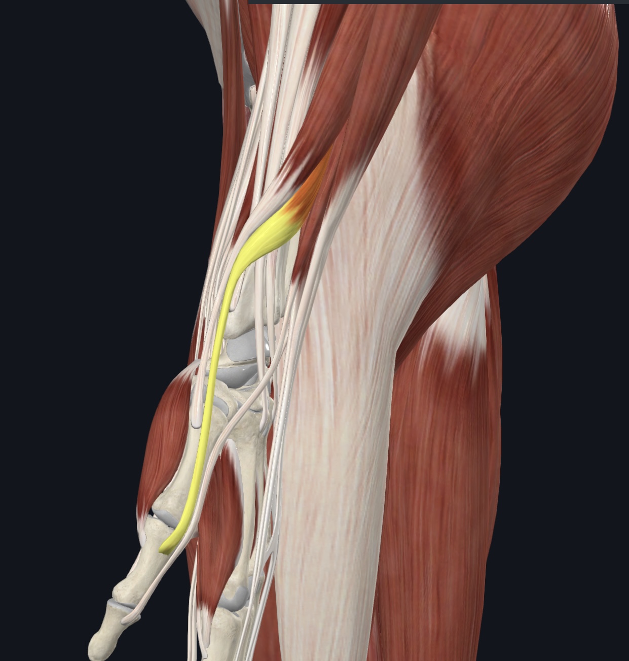 term image