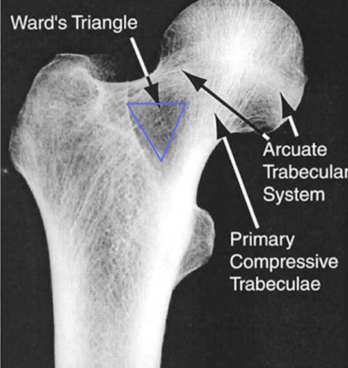 <p>zone of weakness in femoral neck, no crossing of trabeculae, more potential for failure, fractures and osteoporosis</p>