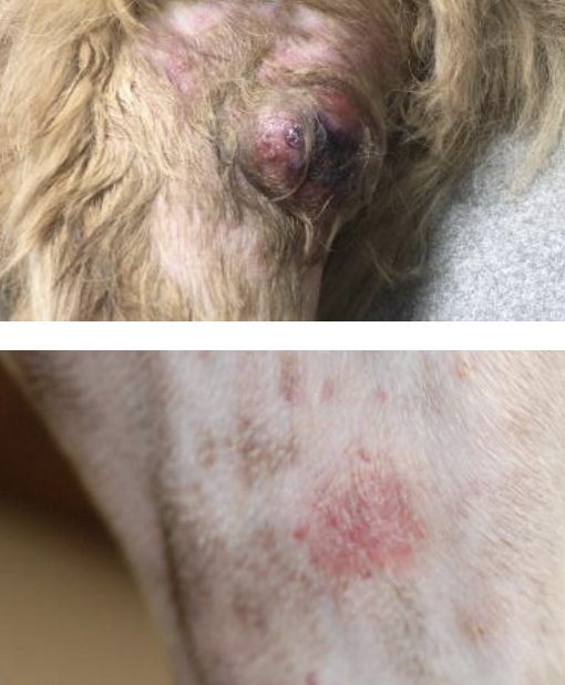 <p>small, discrete, blood-blister-like lesions to much larger deeply seated, painful, bruised and/or bleeding masses</p>