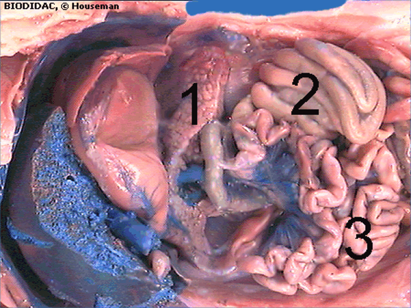 <p>#1. (The liver is cut and stomach lifted for you to view this structure.)</p>