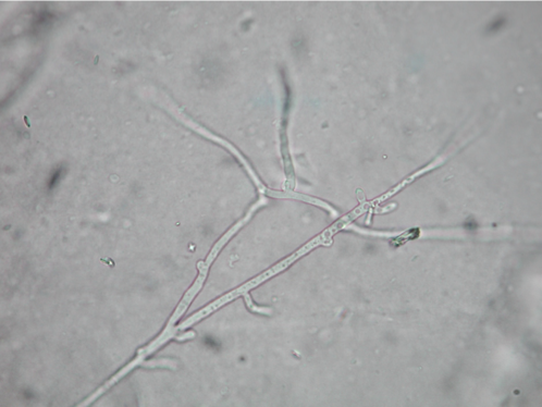 <ul><li><p>Clamp connections</p></li><li><p>No spores</p></li><li><p>y-branching</p></li><li><p>Cross walls</p></li></ul><p></p>