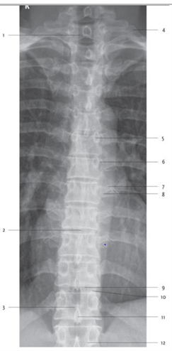 <p>Articulatio costotransversaria</p>